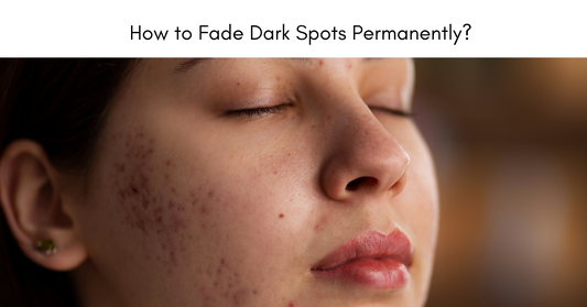 Say Goodbye to Pigmentation: How to Fade Dark Spots Permanently !