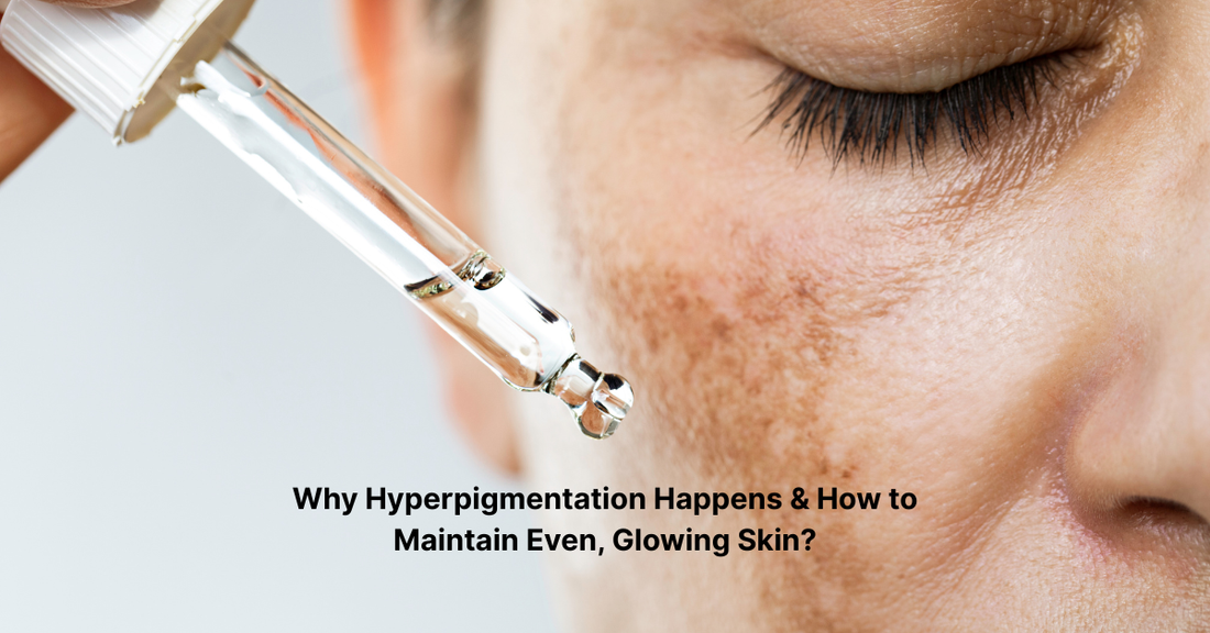 Why Hyperpigmentation Happens & How to Maintain Even, Glowing Skin?