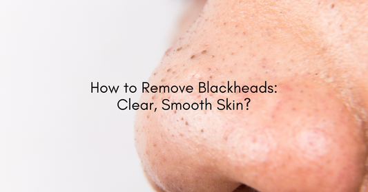 How to Remove Blackheads: Clear, Smooth Skin?