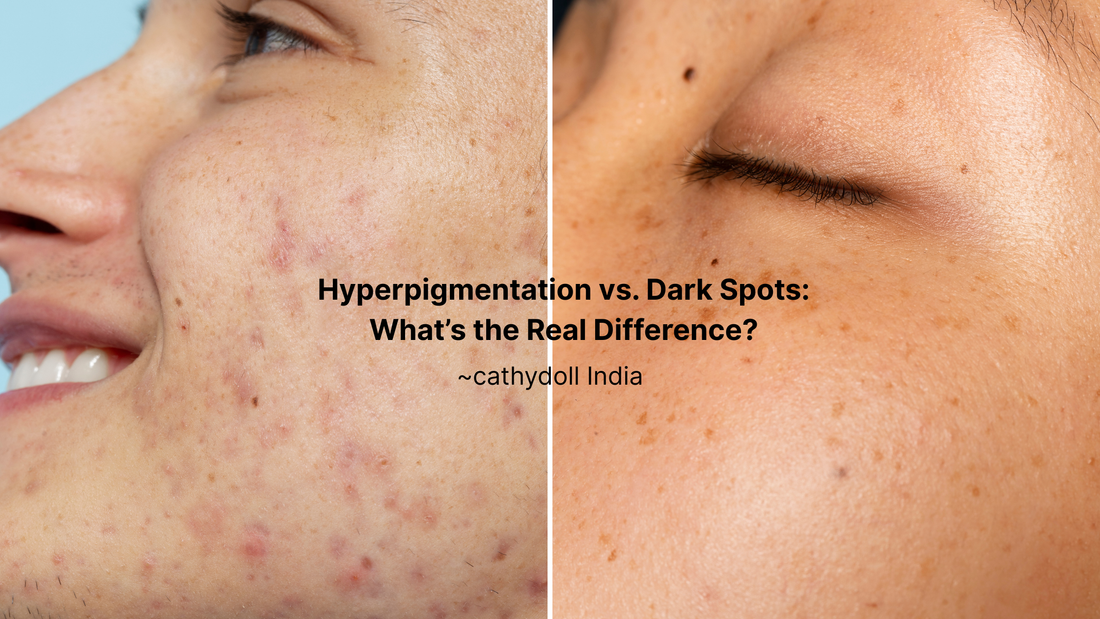 Hyperpigmentation vs. Dark Spots: What’s the Real Difference?