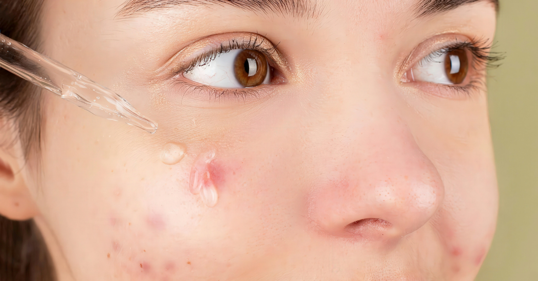 Serum for Dark Spots and Pigmentation - Cathy Doll