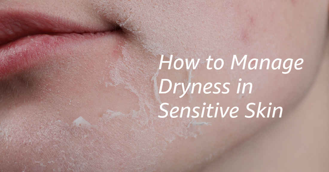 How to Manage Dryness in Sensitive Skin? Gentle Tips That Actually Work