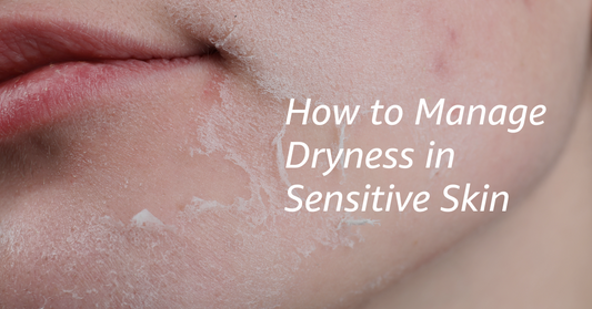 How to Manage Dryness in Sensitive Skin? Gentle Tips That Actually Work