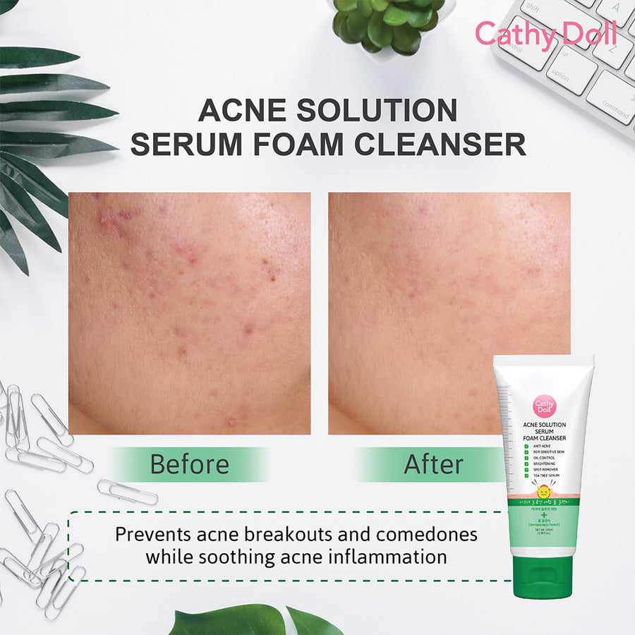 Acne Solution Serum Foam Cleanser